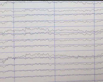תמונה ראשית מעבדת EEG - נבדקות במעבדה